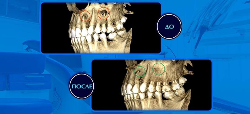3D томография 