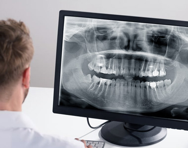 Современная рентгенодиагностика- прицельная рентгенография, цифровая панорамная рентгенография