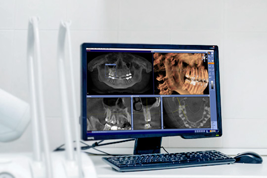 Компьютерная томография зубов: 3D диагностика челюсти