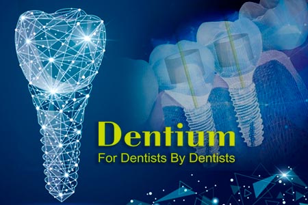 Dentium – имплантационная система по демократичной цене
