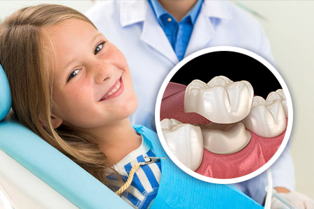 Коронки детям на молочные зубы: когда и зачем