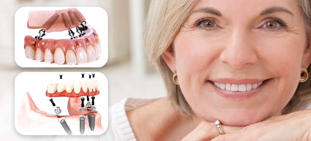 Удобство прежде всего