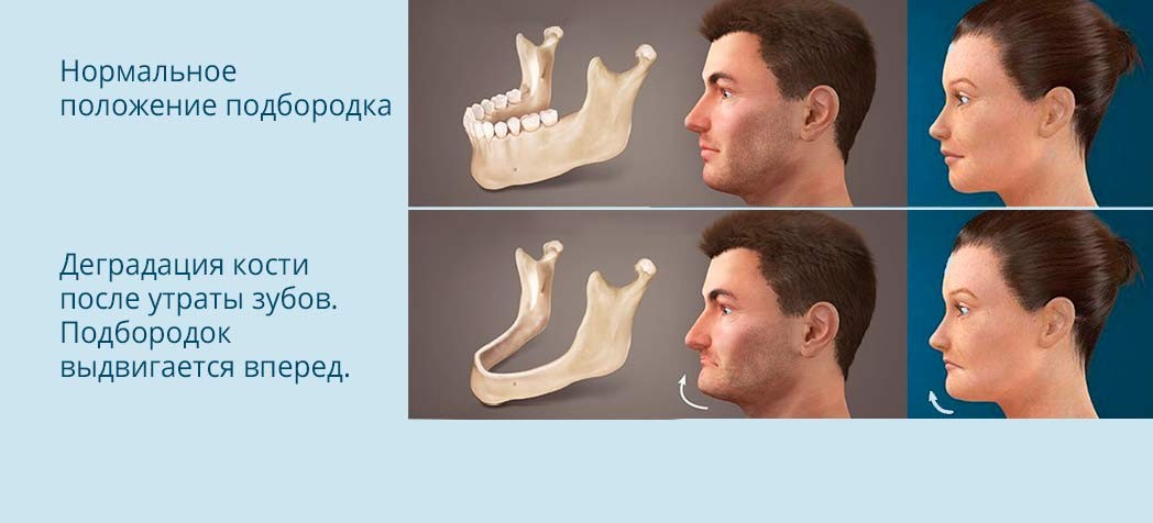 Моментальная нагрузка