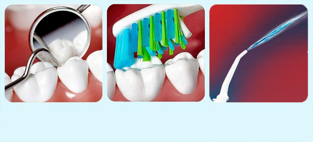 Уход - как за своими зубами