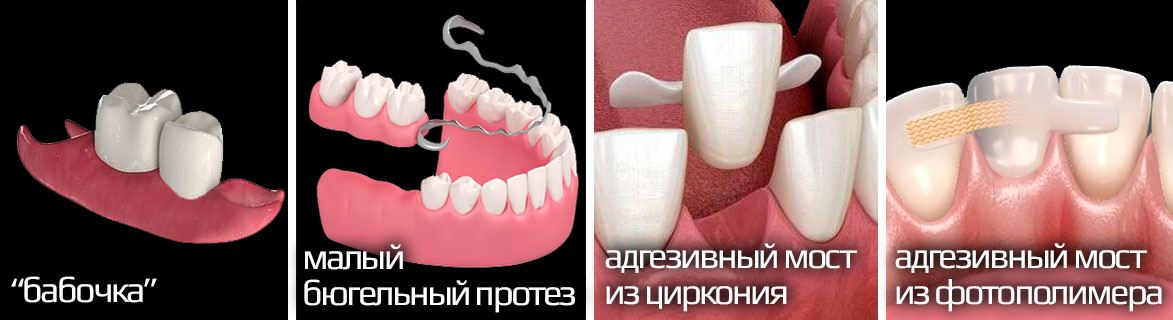 Как правильно называется щель между передними зубами?