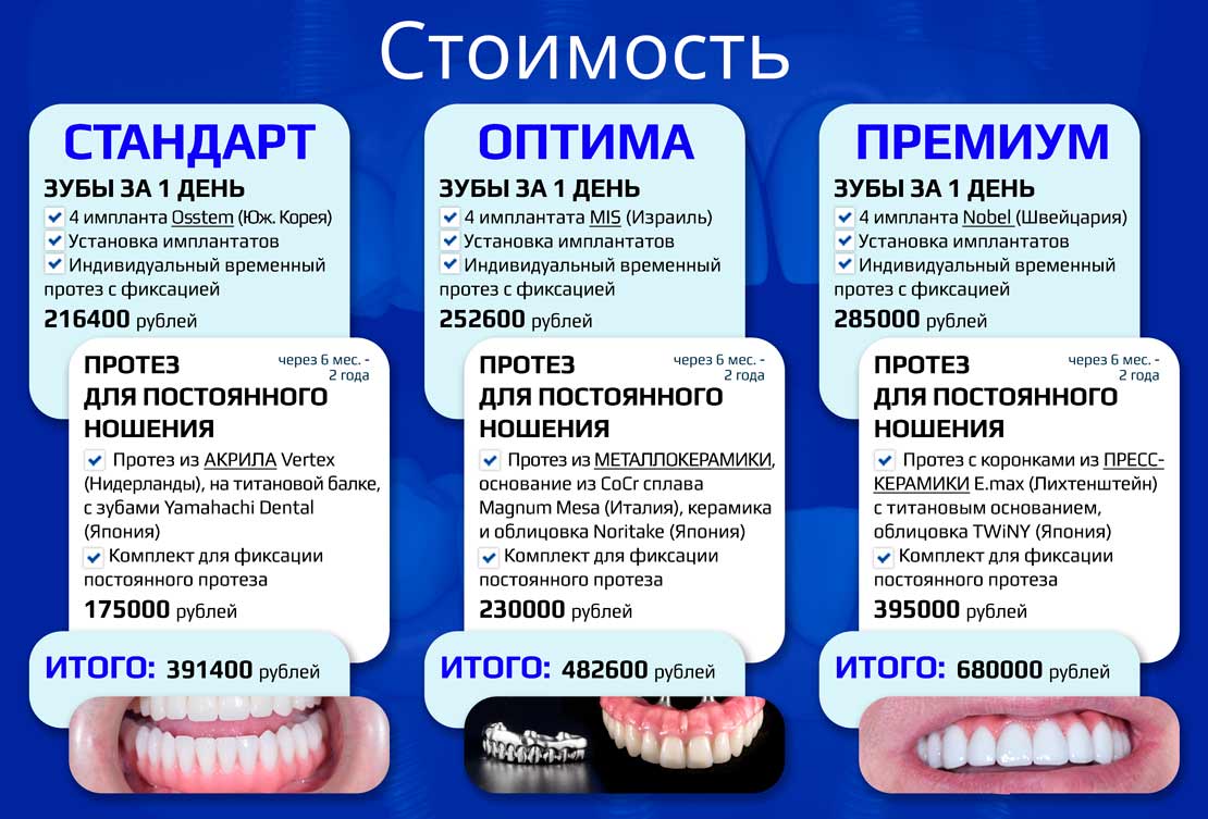 Варианты стоимости All-on-4